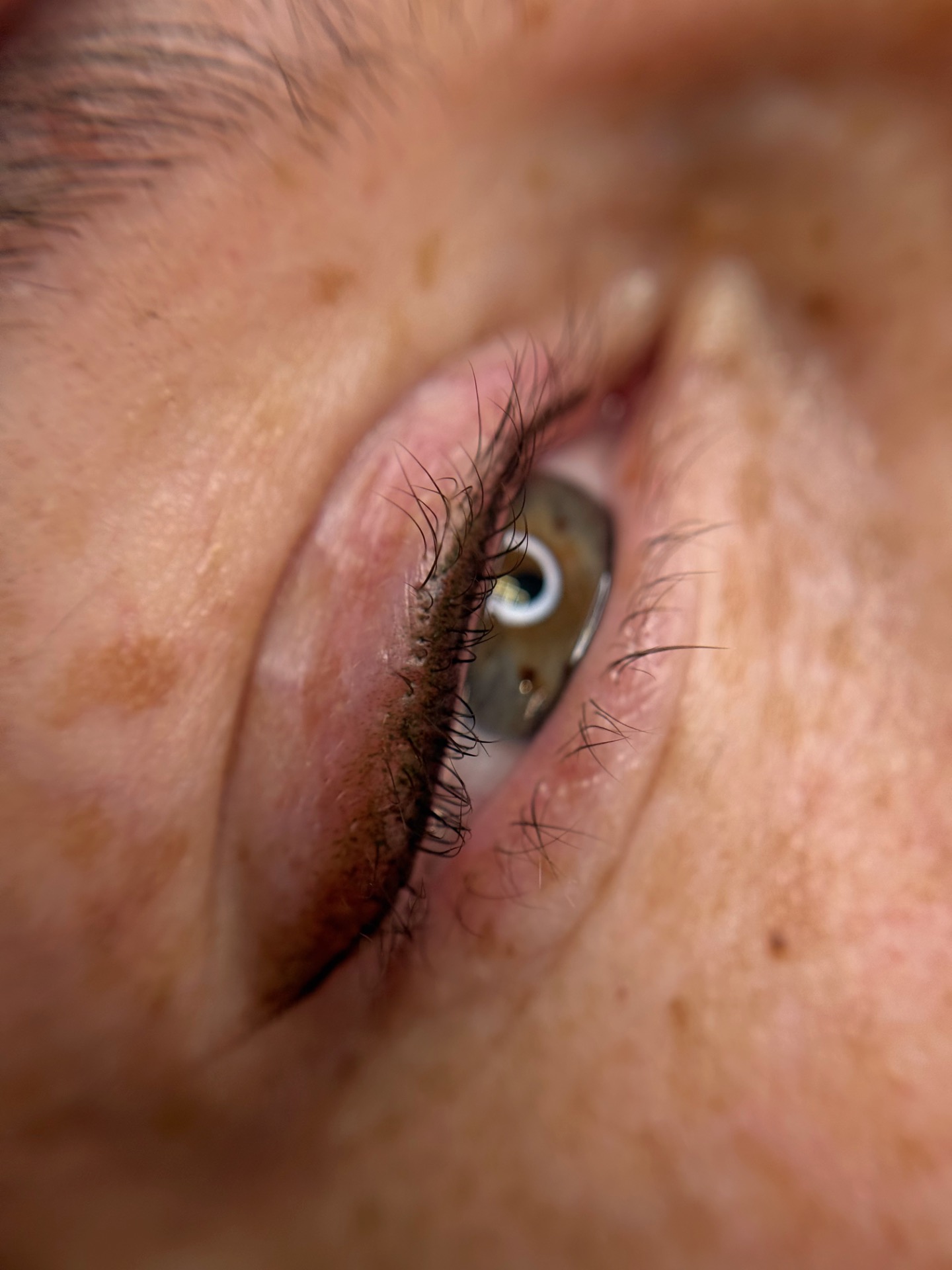 Pēc pirmās procedūras