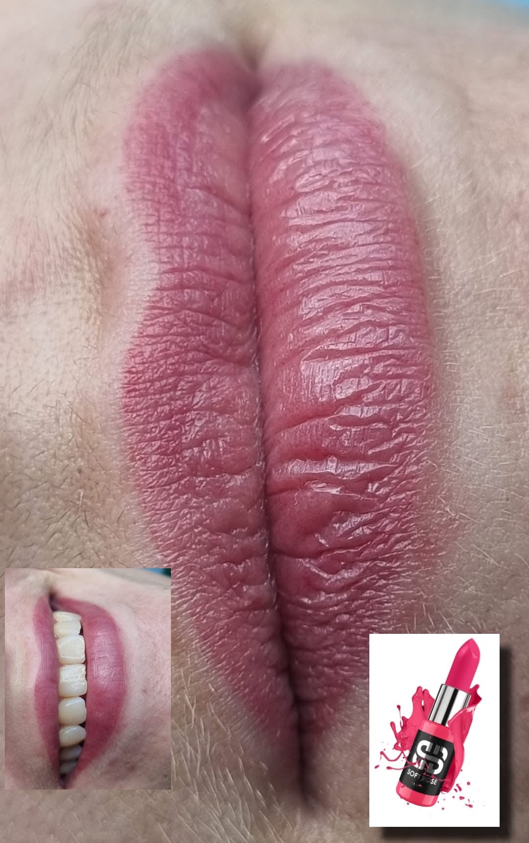 Sadzijušas pēc pirmās procedūras